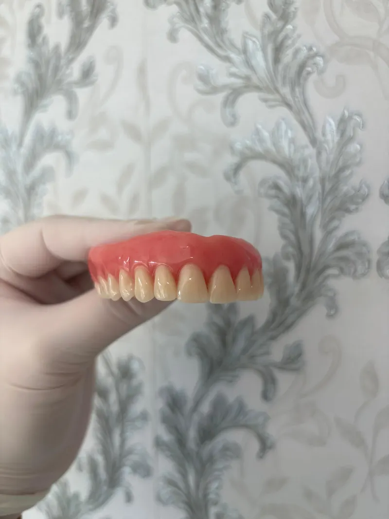 Uma mão segura uma prótese dentária superior diante de uma parede de papel de parede cinza.